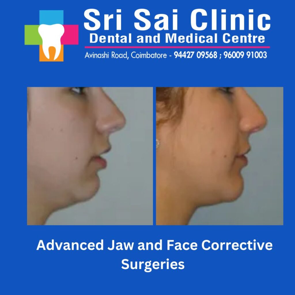 Face and Jaw correction surgery at sri sai dental clinic coimbatore 