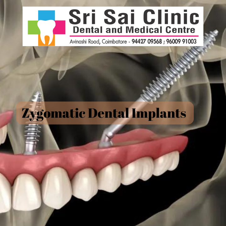 leading dental implant center in Dwarka And The Art Of Time Management