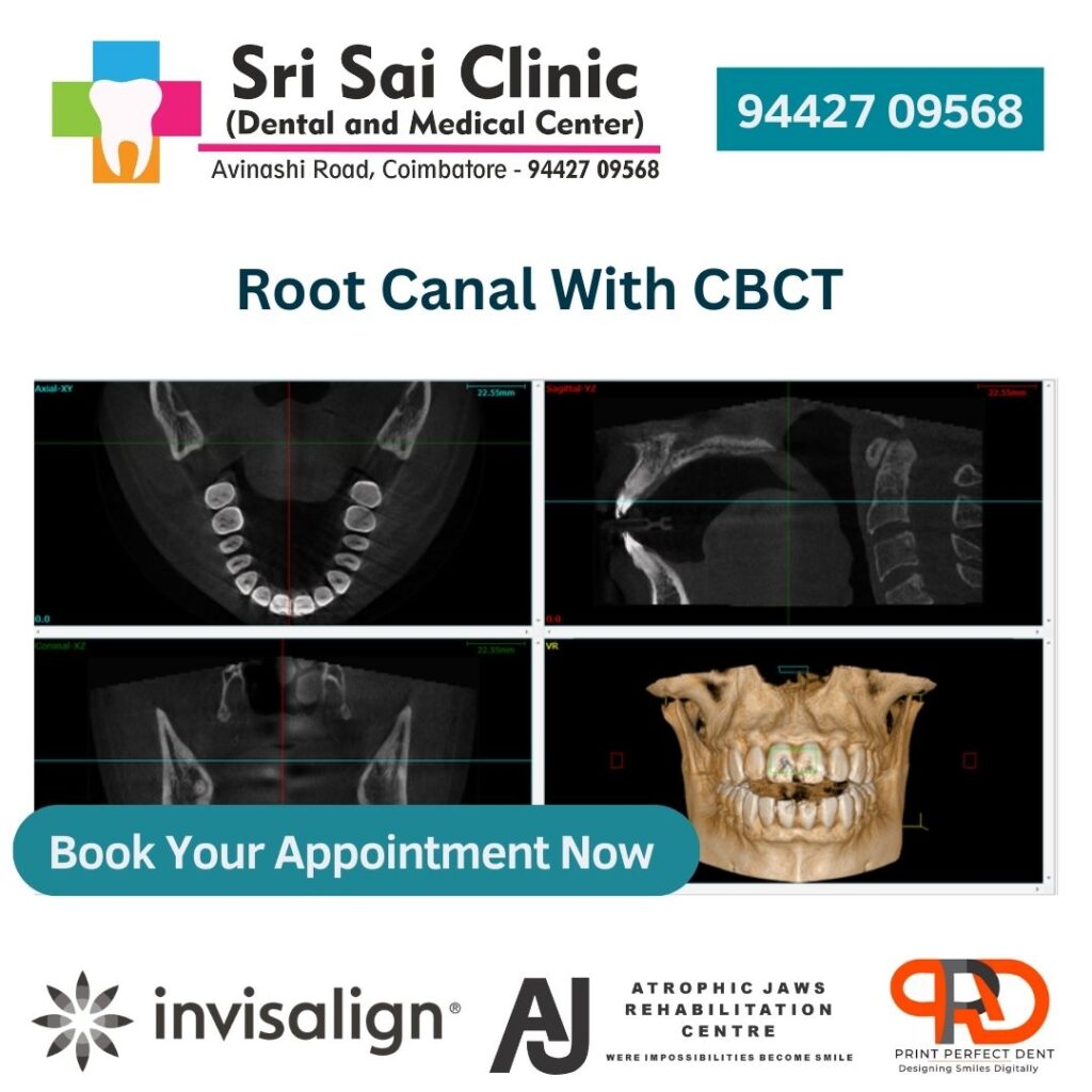 best root canal treatment in coimbatore